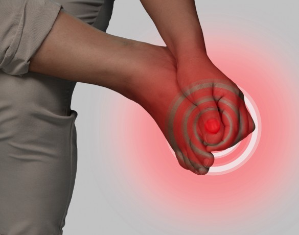 Unha encravada (onicocriptose)